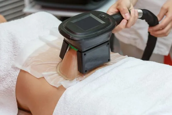 Image of person having fat freezing treatment to help weight gain Lichfield