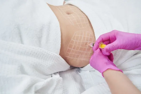 image of fat dissolving injections on love handles to help combat weight gain Lichfield