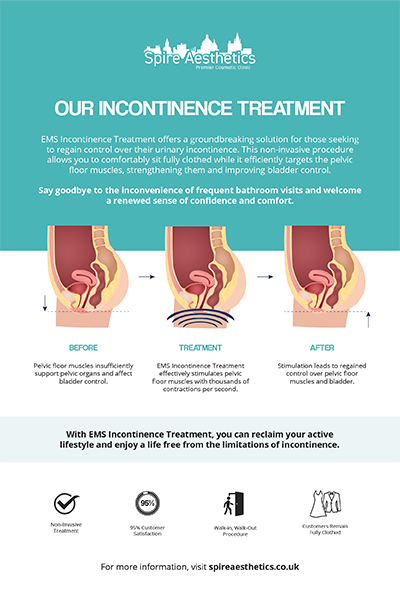 image to show how EMS treatment works for female urinary incontinence Lichfield