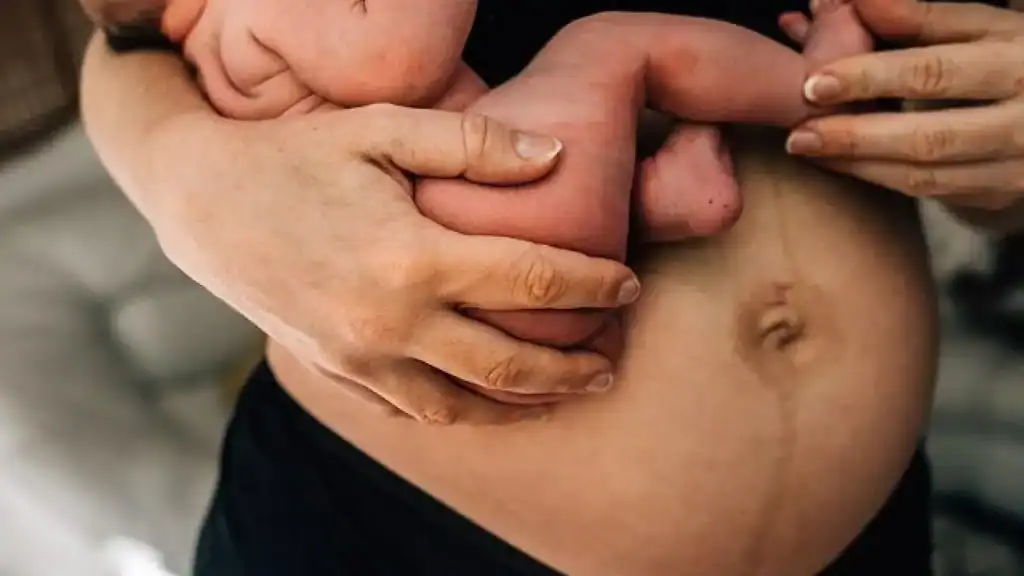 Why Is My Stomach Still Big After Pregnancy Lichfield?